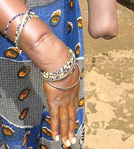 And what have governments in Sierra leone done for her kind?