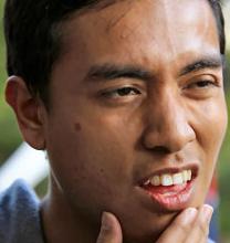 The Malaysian student Ashraf Hasiq Rosli nursing a broken jaw