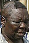 The MDC leader after a brutal attack by ZANU-PF operatives