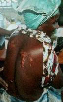 Female victim of rape and torture - Photo: Human Rights Watch